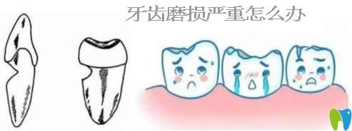 深挖牙齒磨損的原因,了解牙齒磨損會(huì)自動(dòng)修復(fù)嗎及如何修復(fù)