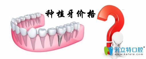 通過重慶種植牙價格表來揭秘重慶種植牙多少錢一顆？