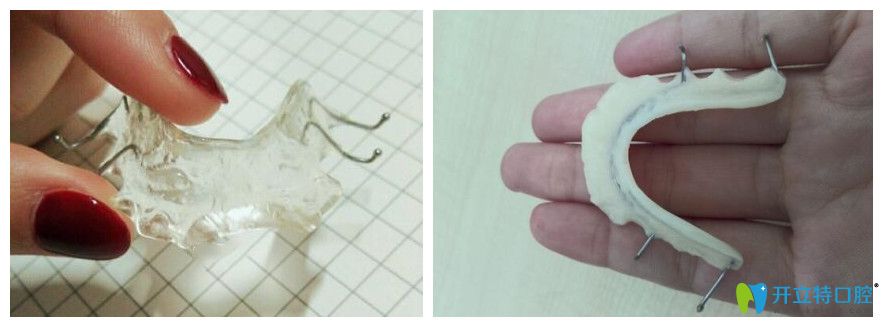 正畸平導(dǎo)的原理及作用