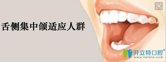 舌側(cè)集中頜全口排列適應(yīng)人群：