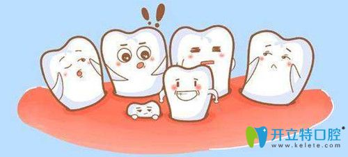 阻生牙拔不拔竟然和阻生牙的種類有關