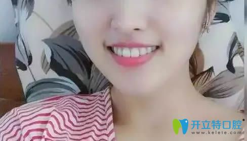 在南陽(yáng)澤康口腔做牙齒矯正歷程體會(huì)：很麻煩但值得！