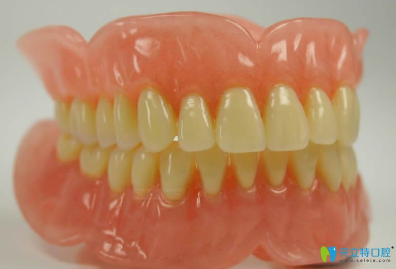 內(nèi)行人解析日本松風(fēng)塑鋼牙的價(jià)格需要多少錢?質(zhì)量好不好？