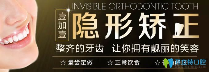 西安壹加壹隱形矯正讓你擁有靚麗笑容