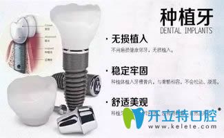 沈陽歡樂口腔科普種植牙的適應人群及參考價格