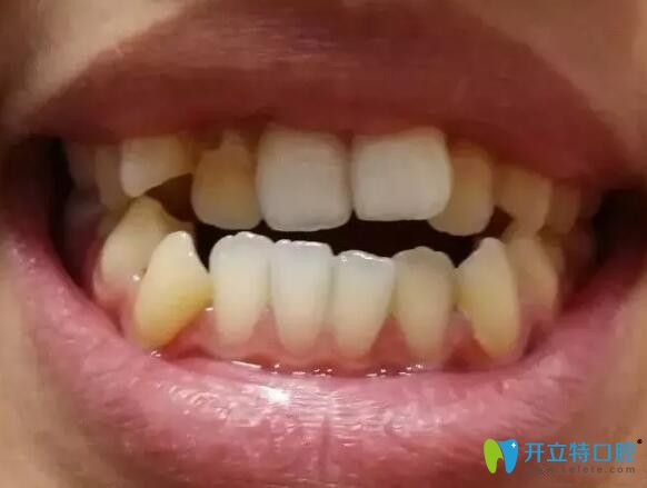 感覺(jué)我在松桃鵬博口腔做陶瓷托槽矯正的價(jià)格和效果成正比