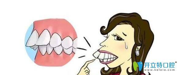 做過(guò)掩飾性正畸可以正頜嗎？真人經(jīng)驗(yàn)分享