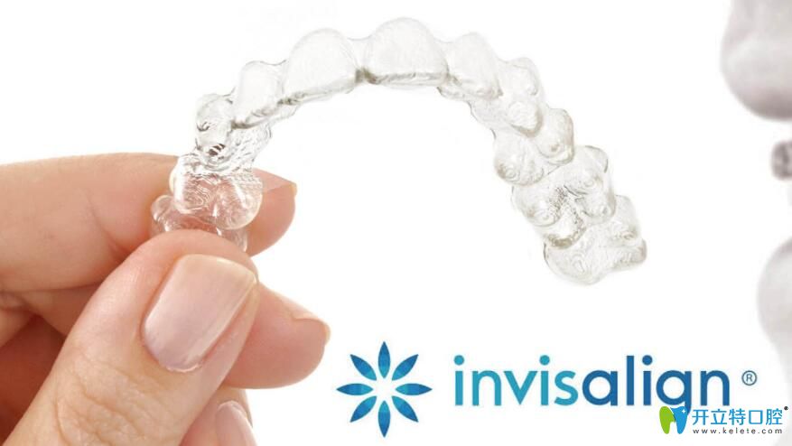 隱適美隱形矯正