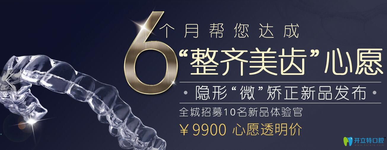 上海英博口腔快速矯正牙齒技術(shù)—矯正僅需6個(gè)月,招募體驗(yàn)官