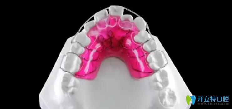 活動矯正器優(yōu)缺點