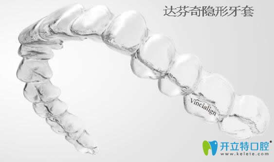 知否:國(guó)產(chǎn)達(dá)芬奇隱形牙套多少錢(qián)及矯正效果怎么樣