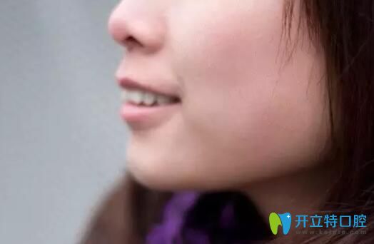 在鄭州德正口腔矯正齙牙雖然沒拔牙，但正畸效果還合我意
