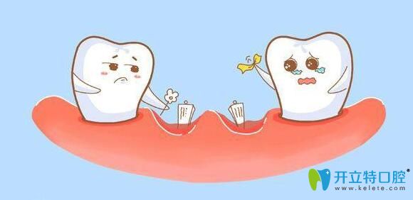 連保強科普：牙齒缺失有什么影響