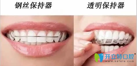整理一份鋼絲保持器和透明保持器的常見(jiàn)問(wèn)題答案