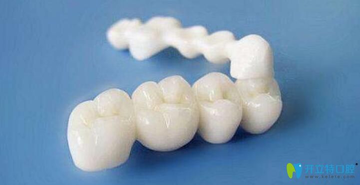 門牙是烤瓷牙怎么矯正