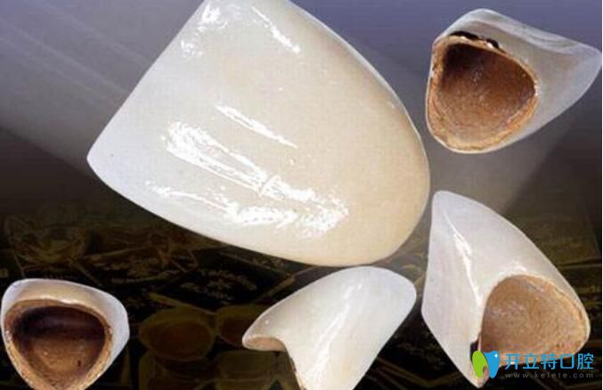 如果是門牙單顆是烤瓷牙的如何矯正