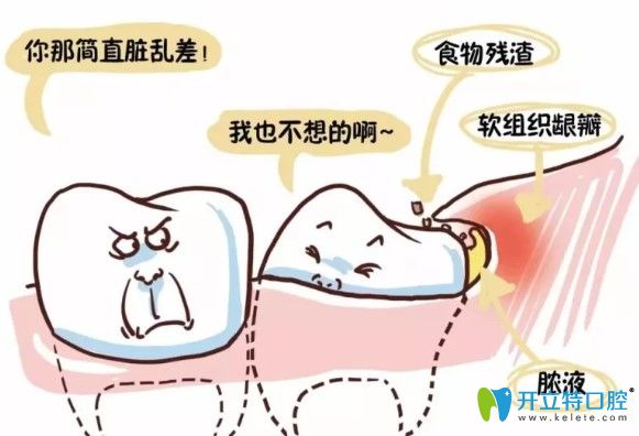 出現(xiàn)這樣的情況智齒就要拔除 出現(xiàn)這樣的情況智齒就要拔除