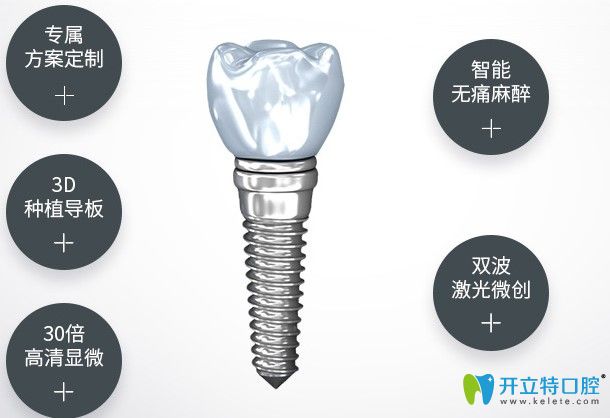 杭州美奧口腔種植牙優(yōu)勢(shì)