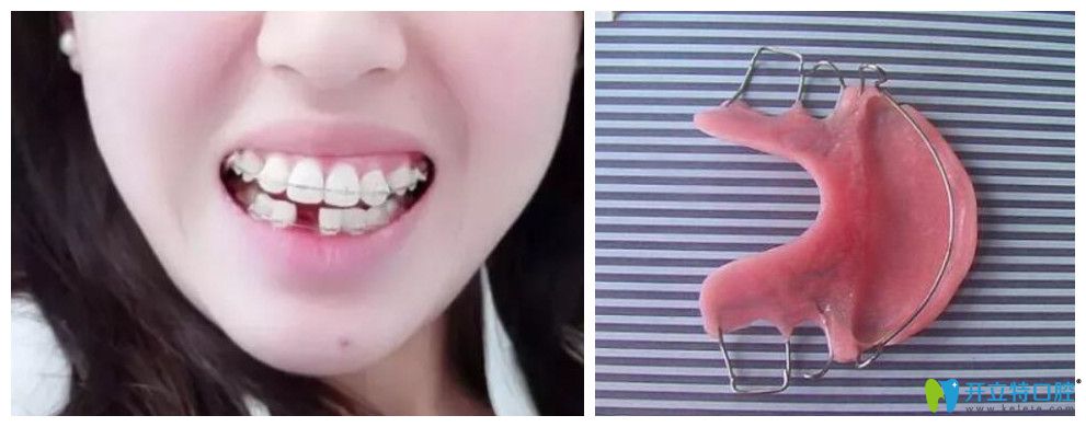 真人談戴平導(dǎo)是什么體驗(yàn)