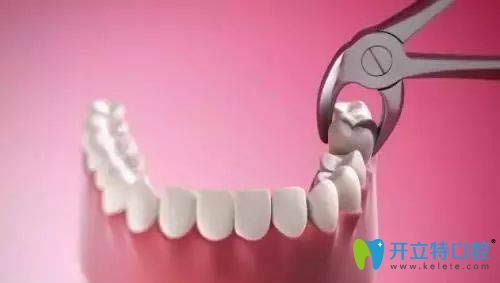 不拔牙矯正效果好不好?連江縣明輝口腔院長是這樣說的.....