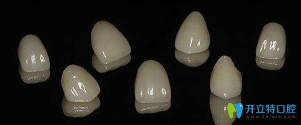 全瓷牙的優(yōu)勢(shì)