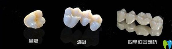 當(dāng)牙齒缺損時，選擇單冠好還是連冠好？