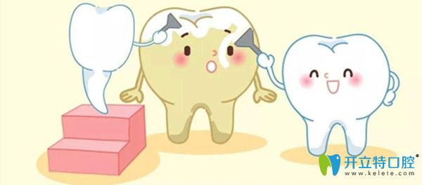 口腔皓齒美白的優(yōu)勢(shì)