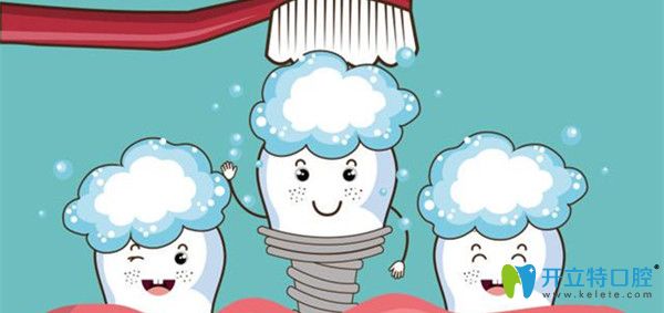 種植牙后要重視口腔衛(wèi)生的維護(hù)