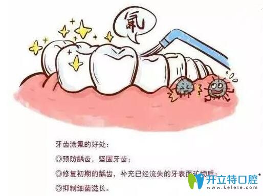 泉州維樂口腔董龍福醫(yī)生介紹兒童牙齒涂氟