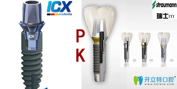 德國icx和瑞士iti種植體PK看哪個好