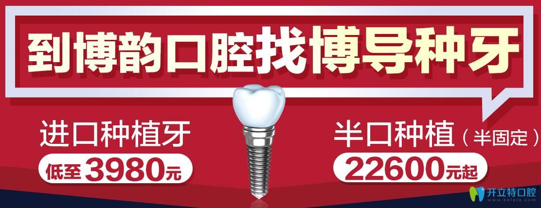 南京博韻口腔找博導(dǎo)種牙，半口種植（半固定）才49800元起