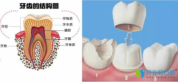 等待修復(fù)體的時(shí)間段戴臨時(shí)冠的作用很重要