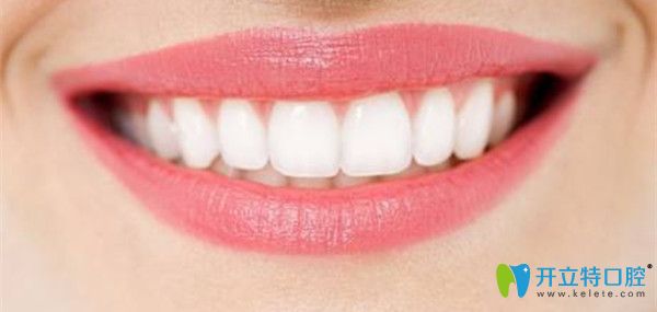 健康的牙齒需要做好口腔清潔