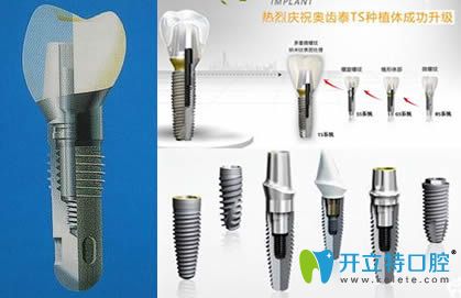 韓國(guó)奧齒泰種植牙種植體