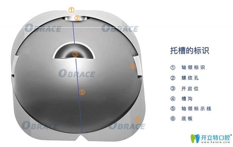 為什么要選擇obrace球面自鎖托槽矯正牙齒？答案在這里……