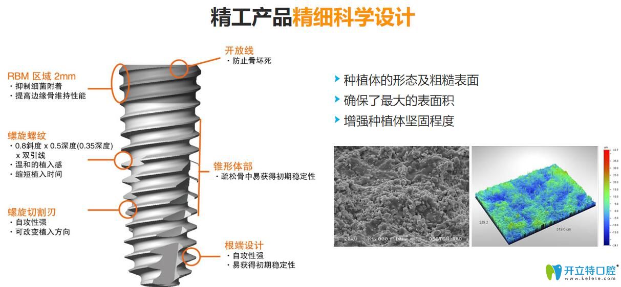 韓國奧齒泰種植系統(tǒng)
