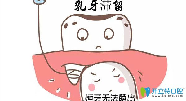 融合牙換牙后會(huì)好嗎