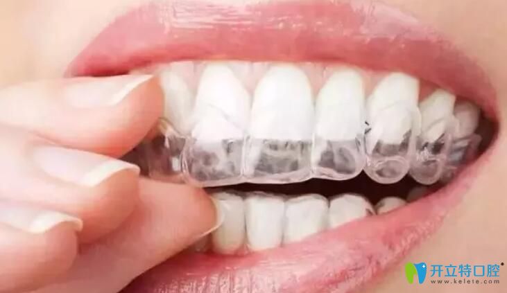 正畸咬膠使隱形牙套更貼合，更隱形
