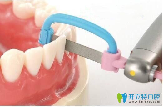 請(qǐng)看：正畸中鄰面去釉對(duì)牙齒有危害嗎？