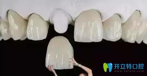 解答：做了全瓷牙基牙爛掉的概率高嗎？