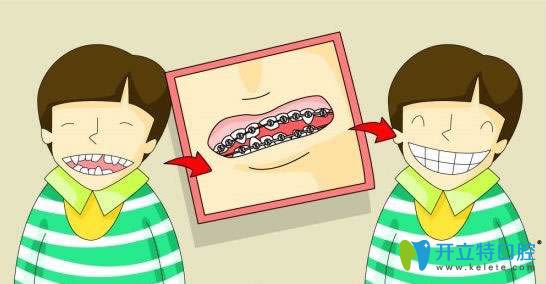 湯立媛醫(yī)生講解兒童牙齒矯正的重要性 湯立媛醫(yī)生講解兒童牙齒矯正的重要性