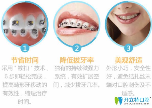 選擇青島諾德齒科黃主任做牙齒矯正的技術(shù)優(yōu)勢 選擇青島諾德齒科黃主任做牙齒矯正的技術(shù)優(yōu)勢