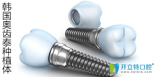 韓國(guó)奧齒泰種植體是純鈦的嗎?優(yōu)缺點(diǎn)及osstem種植牙價(jià)格一覽