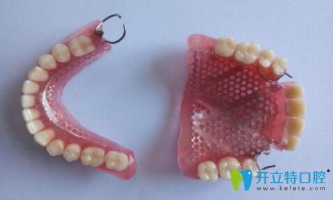 重慶維樂(lè)口腔李天游科普：假牙壞了怎么辦