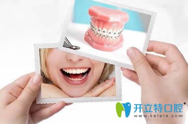 劉慶醫(yī)生科普牙齒矯正為什么會痛