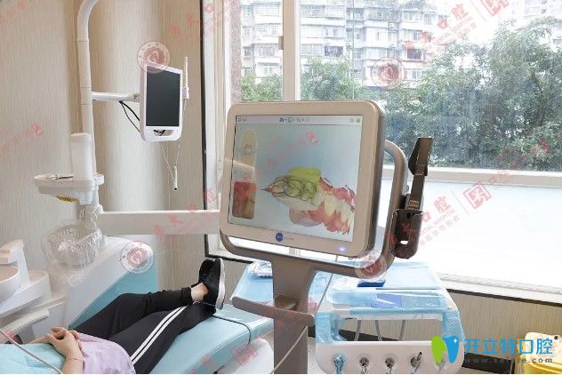 廣州廣大口腔iTero口掃儀