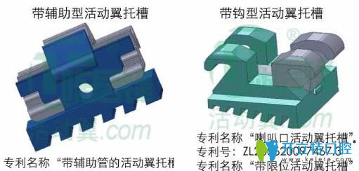 活動(dòng)翼矯治器兩種類型