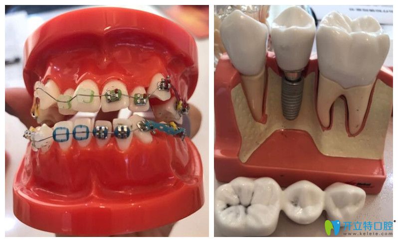 中山好民生口腔特色技術(shù)