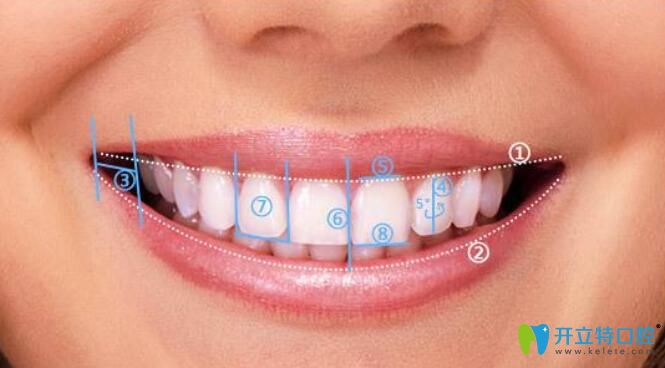 中山美南華口腔矯正優(yōu)勢(shì)
