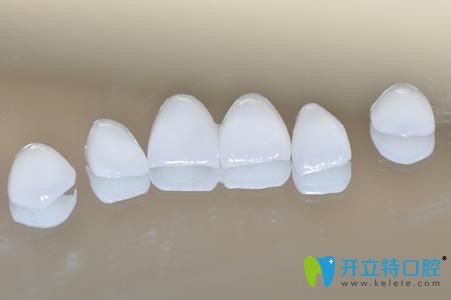 南昌輝煌口腔錢<!--<i data=20240703-sp></i>-->介紹牙齒貼面的優(yōu)勢(shì) 南昌輝煌口腔錢<!--<i data=20240703-sp></i>-->介紹牙齒貼面的優(yōu)勢(shì)